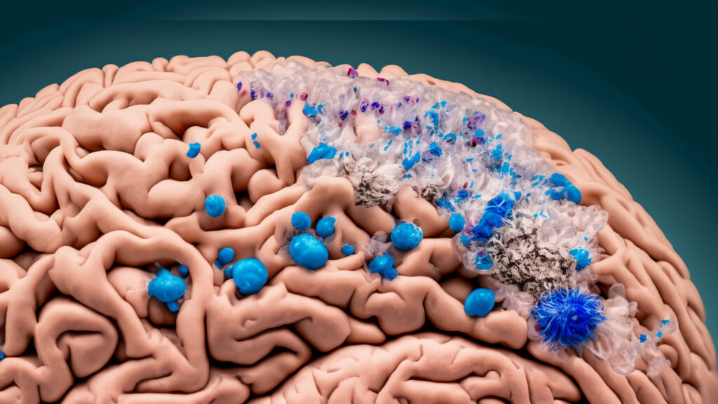 How Microplastics Affect Your Brain