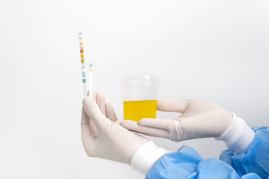 What Does Your Urine Color Actually Mean?