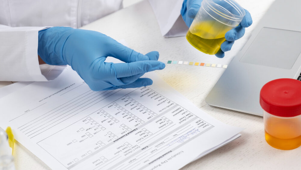 different-urine-colors